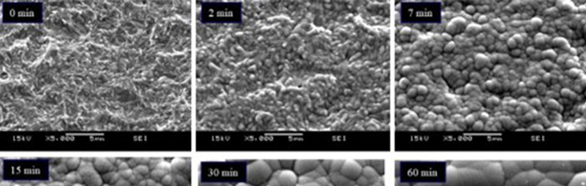 ENEPIG Corrosion Mechanisms